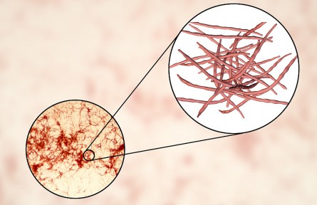 科技名詞 | 放線菌  Actinomycete